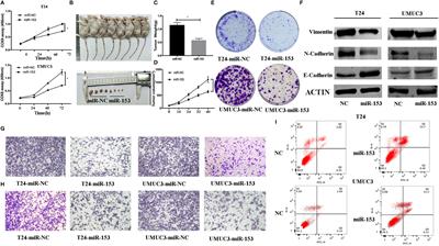 Corrigendum: MicroRNA-153 decreases tryptophan catabolism and inhibits angiogenesis in bladder cancer by targeting indoleamine 2,3-dioxygenase 1